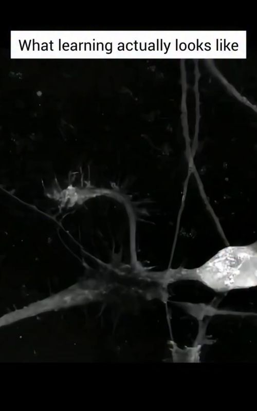 If you could watch your brain learn, it would look exactly like this—tiny sparks reaching out, forming new connections, rewriting who you are in real time. Learning isn’t just something you do—it’s something your brain builds. Every time you practice a skill, recall a fact, or try something new, your neurons fire together and form stronger, faster pathways. This process is called neuroplasticity, and it’s your brain’s incredible ability to rewire itself throughout your entire life. At first, those pathways are weak—like soft pencil lines. But with repetition, focus, and curiosity, they become bold, permanent strokes. The more often certain neurons communicate, the more efficiently they send signals, making the skill or idea feel easier, more automatic, and more natural to you. What’s even more amazing? Your brain prunes away old, unused connections to make space for new ones. It’s constantly editing, reshaping, and optimizing itself based on how you use it. That means your habits, thoughts, and behaviors literally sculpt your brain’s structure. So when you’re learning—struggling through something new, feeling that mental “stretch”—those glowing connections you see in this video are happening inside you. Growth isn’t invisible. It’s physical, electrical, and beautifully alive. Every new skill is a new network. Every new idea is a new connection. And your brain is always ready to change—every single day. ✅Follow @drdavidabbasi for More Daily Medical Content & Health Tips! 🌴😷Schedule a consultation to see Dr. Abbasi as a patient in Delray Beach! Visit www.primeorthocenter.com
