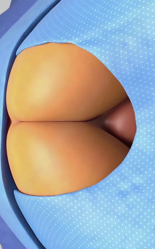 Stapled Haemorrhoidectomy using the PPH System (3D Animation) #stapledhemorrhoidectomy #stapledhemorrhoid #hemorrhoids #hemorrhoidectomy #hemorrhoidsurgery #piles #pilessurgery #medical3danimation #3dmedicalanimation