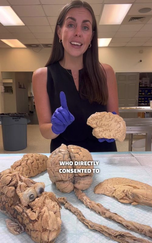 🧠 The Human Nervous System! 🧠 #anatomy #humanbody #brain #nervoussystem #Science #stem #scienceteacher #humananatomy #nowyouknow #education #tiktokteacher @Experience Anatomy 