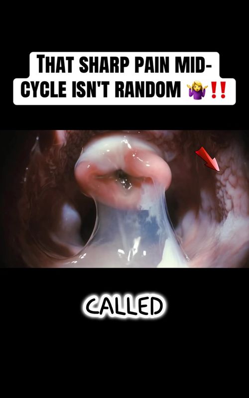 Mittelschmerz: ovulation pain explained. 👀 Your follicle ruptures. Fluid irritates nerves. THAT'S the sharp pain. It's not random. It's biological. Comment: LEFT or RIGHT side?"   #Mittelschmerz #OvulationPain #CycleTracking #TTCJourney #fertilityawareness 