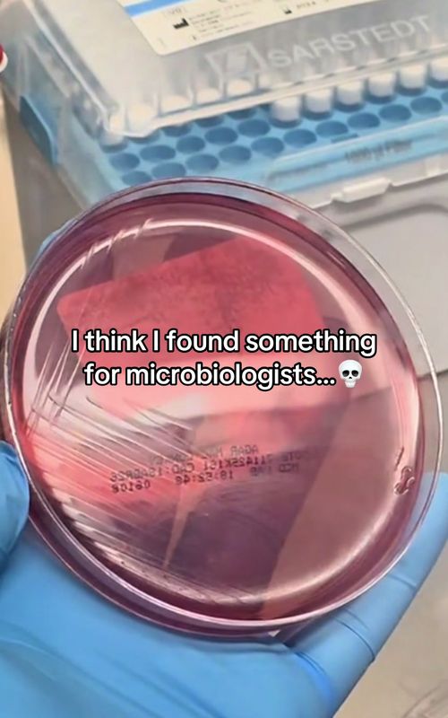This is for the microbiology students…🧫 #microbio #lablife #wetlab #ScienceTok #biology 