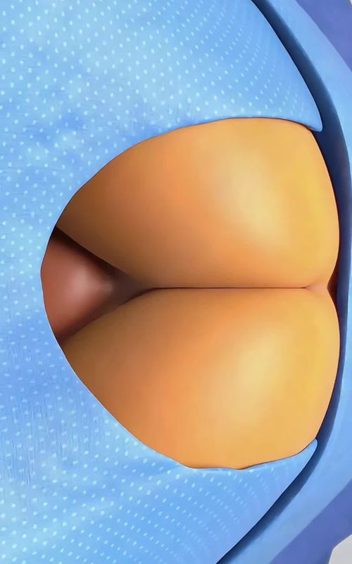 How Enema Therapy Works | 3D Medical Animation #DigestiveHealth #ColonHealth #MedicalAnimation #3DMedical #HealthEducation #Wellness #Anatomy3D #MedicalVideo #Healthcare #safecontent 
