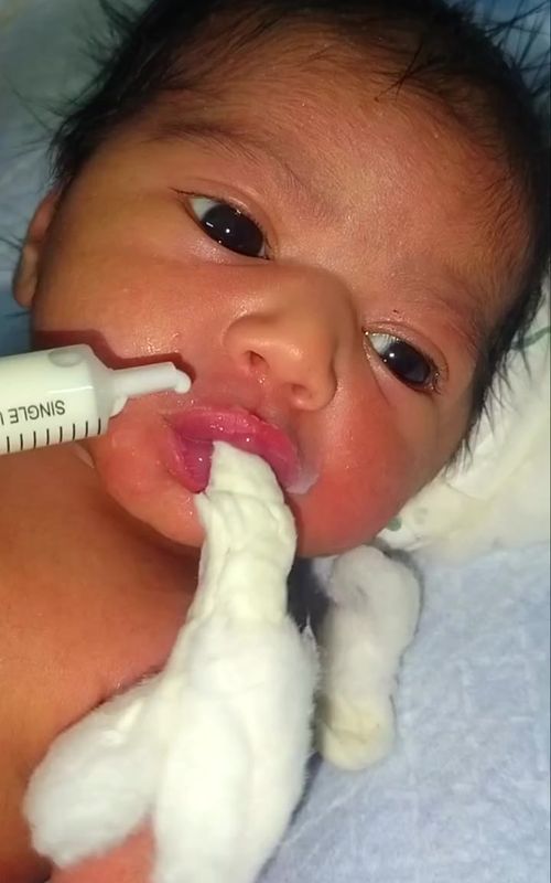 Have you ever wondered how babies in the NICU are being fed?? Well wonder no more. In the NICU, some premature or weak babies are fed breast milk using cotton. This method helps babies who cannot breastfeed yet to receive nutrition safely😊 #nicu #newborn #breastmilk #feeding #learning 