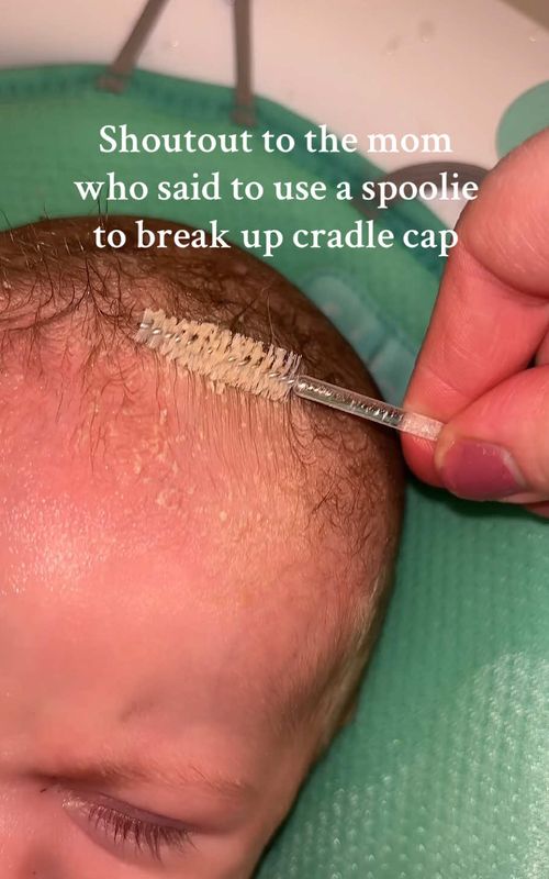 Best mom hack everrr #cradlecap #newborn #newbornlife #momhacks 