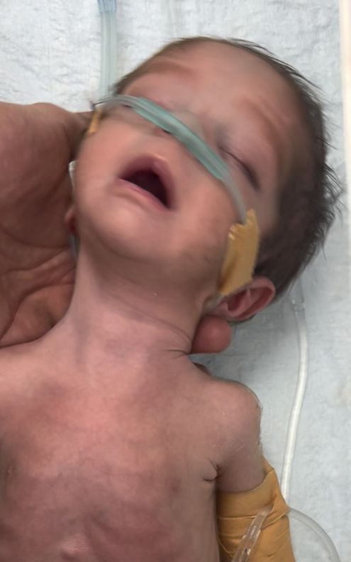 baby not responding from 20 days #newborn #medical #latecry #babycare #usa🇺🇸 