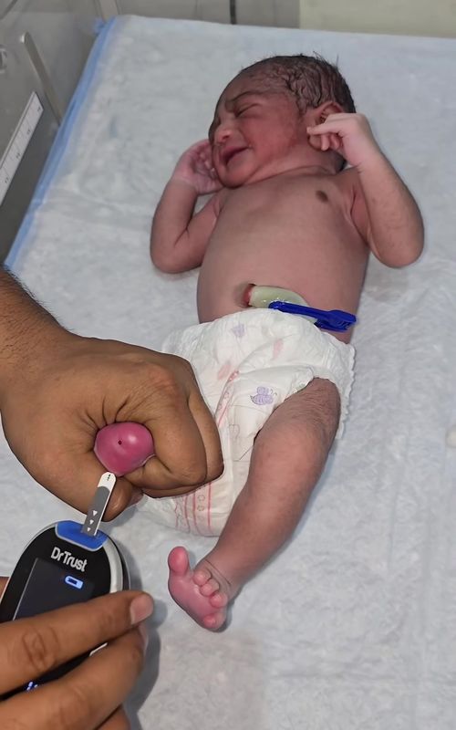 Preterm baby RBS Monitor  #newborn  #glucose #babygirl #nicubaby #rbs 
