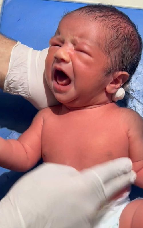 After delivery baby not cry 😭 #mommy #newborn #usa🇺🇸 #unfreezemyaccount 