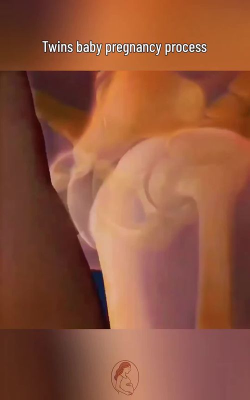 Twins baby Fertilization process inside womb.  #LearnOnTikTok #educationalpurposesonly 