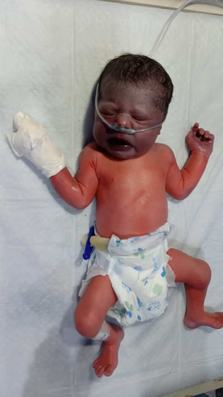 Newborn Resuscitation Step by Step | Initial Care, Suction, RBS & Temperature Check #NewbornResuscitation #NeonatalCare #NICUCare #InitialCareOfNewborn #NeonatalResuscitation