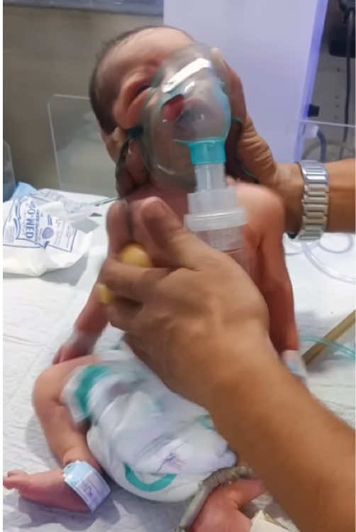 Critical Newborn baby | Chest Physiotherapy, High Oxygen Support & Deep Suction | Emergency Care #NICUCare #CriticalNewborn #NeonatalEmergency#ChestPhysiotherapy #oxygentherapy 
