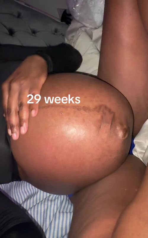 Everything moved so fast, so happy to give birth to 2 healthy premature babies 🩵💙 they’re doing so good for their size 💪🏾 #nicubaby #prematurebaby #preemiestrong #twinpregnancy #momtok 