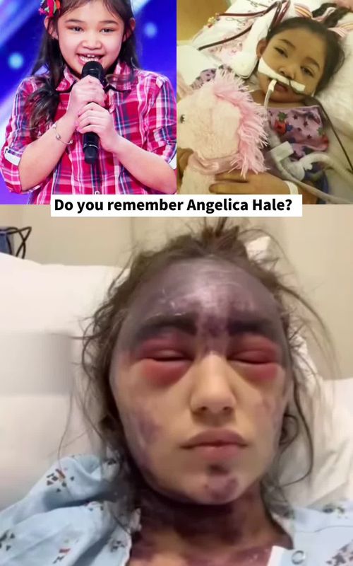 Angelica Hale amazed the world on America's Got Talent - but a life-threatening illness nearly took her voice before fame. #angelicahale #americasgottalent #agt #youngtalent #singer