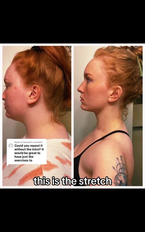 Replying to @Sasstoid   How to fix your neck hump #neckhump #neckhumpfix #neckhumpexercises #neckhumpcorrection #neckpain #neckpainrelief #neckpaintreatment #neckpainexercise #techneck #technecksolutions #techneckhack #techneckstretch #techneckfix #stretch #foryoupage #posture #posturecorrection 