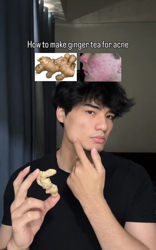 Try this ginger tea every morning to get rid of acne  .  #GlowUp #acne #ginger #skincare @UCHAD App 