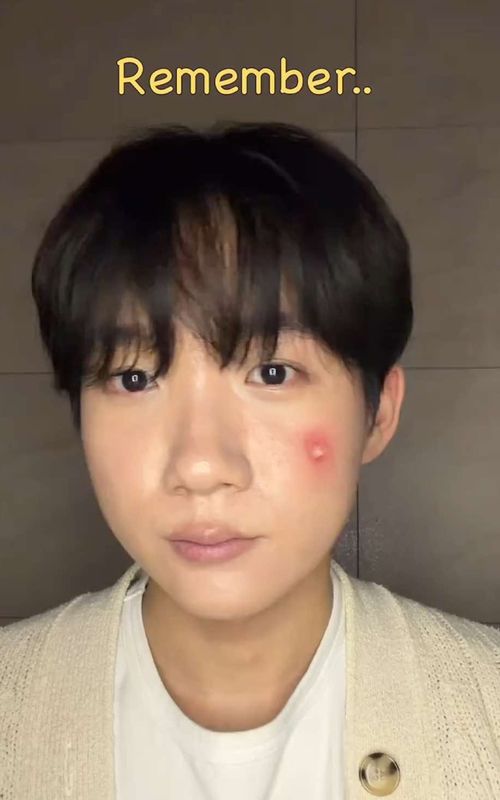 Figure out your acne signals! #kbeauty #koreanskincare #acneproneskin 