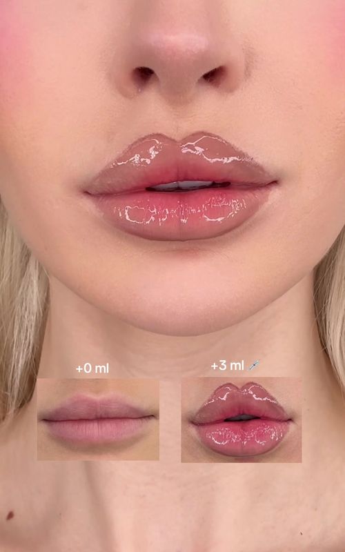 3ml lip filler, for free 💉🤣 would you try this lip plumping hack?  #lipcombo #makeuphacks #makeup #lipliner #makeupinspo 