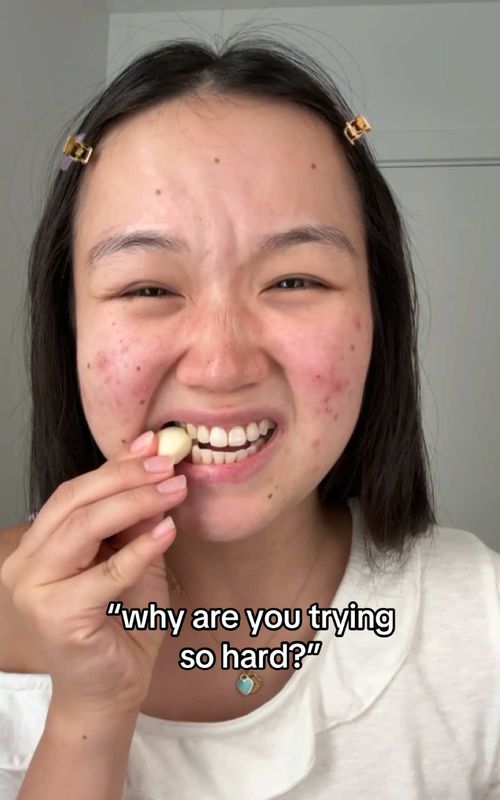 Healing my skin took time, patience, and a lot of change… but it was always for her 🤍✨ #acnejourney #acneskincare #hormonalacne #acnetreatment #clearskin 