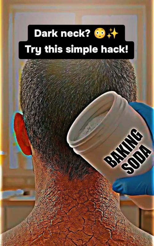 Coconut oil 🥥 + baking soda ✨ This combo may help exfoliate & soften the skin for a brighter look 💛 Be gentle & don’t overuse! #HealthByBiology  #HealthByBiology  #SkincareTips  #DarkNeck  #GlowingSkin  #DIYSkincare  #BeautyTips  #SkinCareRoutine  #Exfoliation  #HealthySkin  #SelfCare  #USABeauty  #HealthyLifestyle  #FYP  #ForYou  #viralskincare 