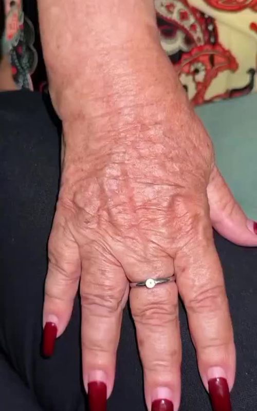 Hand & Feet wrinkles Free Skin at Home #whitening #glowing #beautytips #skincaretips #viralvideo 
