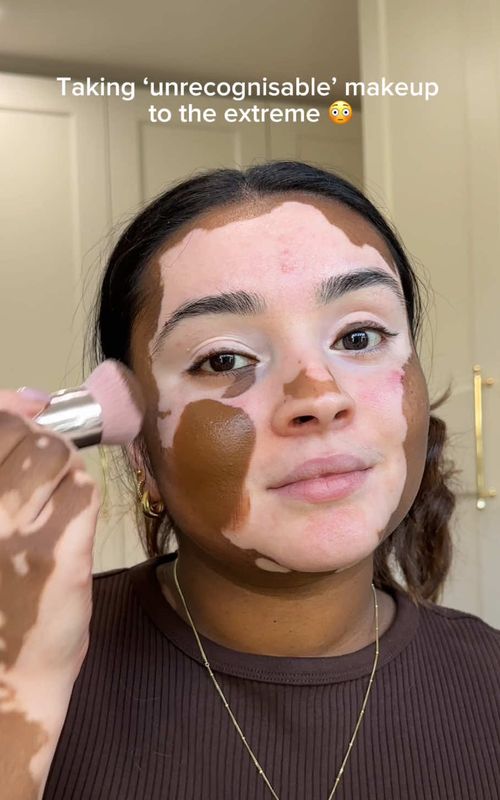 Part of me has always wondered what I’d look like without my vitiligo!  Full tutorial on my YT ♥️ The foundation is Vitacolor by @KryolanOfficial  #makeup #vitiligo #foundation #transition #makeuptutorial 
