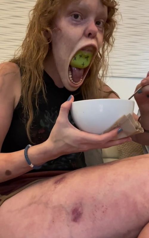 Her Jaw Is Completely BROKEN?! 😅😳😬 #fyp #teeth #dentistry #braces #health #reaction