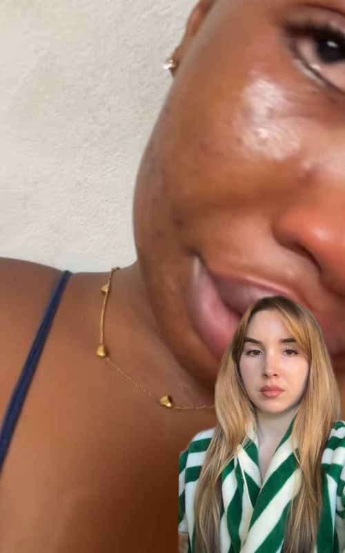 It makes me so mad when I hear about people shaming other people for acne - I don’t know how, in 2026 still, people think that acne is a result of being unclean. And then it’s even more infuriating when people without acne assume it’s because of anything other than luck (when they don’t put effort into maintaining it). ANYWAY this will be my honest suggestions for this girl, Treclin is a combination of a retinoid and an antibiotic. Sometimes it can help in the short term and then you transition to a regular retinoid. The diet and Lifestyle tips at the end are highly controversial, even though they shouldn’t be, I could’ve not included this section because I know people won’t like it, but that is my honest advice and what I would give to you if we were friends and I sent you a voice note. #hormonalacne #skincaretips #skincare 