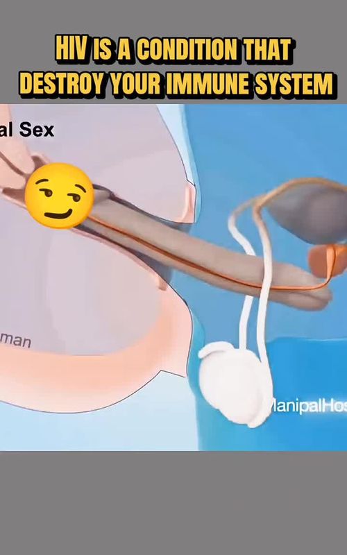 HIV Explained | How It Affects Your Immune System | 3D Medical Animation #HIVAwareness #ImmuneSystem #HealthEducation #MedicalAnimation #3DMedical #PublicHealth #Anatomy3D #MedicalVideo #Healthcare #stayinformed 