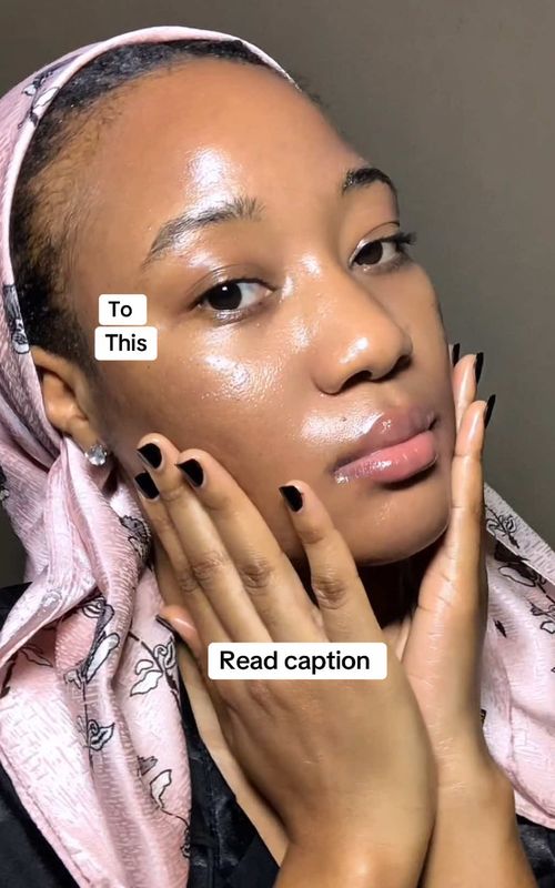I went on “the glow protocol” for clear healthy skin.  - as a doctor I suffered hormonal acne for years, with no drying healing my skin, I had to do things myself, so,  -I went through several trials, studies and research using science backed research and holistic methods to heal my skin and regulate my hormones, and - through this I have helped over 500 women clear their acne too.  - clearing your skin is quite tricky, most important, it takes consistency, mine took me 8months, but it was worth it.  Save this post and Comment “glow protocol” so the algorithm brings you back to the glow master class I will be having in 4 weeks… I’m still working on it.  #skincare #acne #clearskin #skintransformation #skincaretips #transformation #tretinoin #accutane #drrm #GlowUp #glowprotocol 