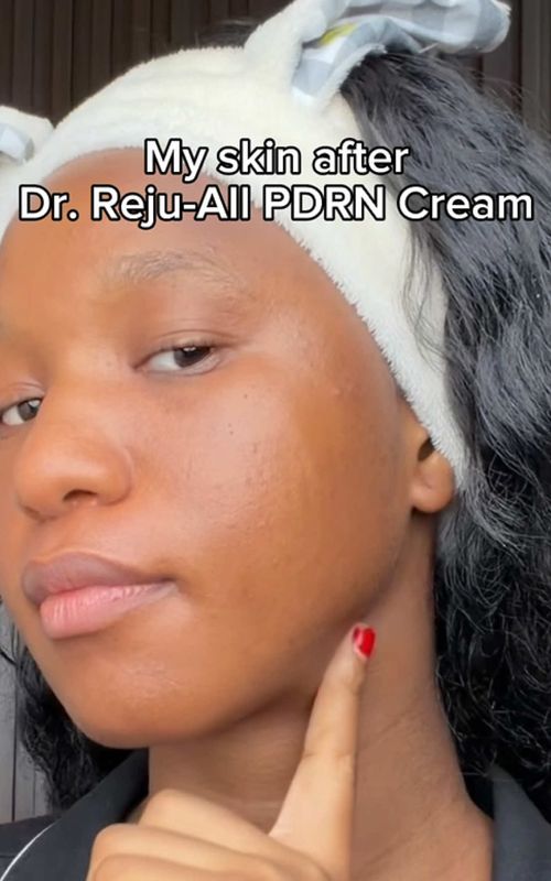 My skin barrier was screaming until I found this 💎 @Dr.Reju-All Store  From irritated, stressed skin to calm, clear, and healthy-looking skin with Advanced PDRN Rejuvenating Cream. Powered by 99% pure medical-grade salmon PDRN to support skin regeneration, soothe irritation, and restore your glow without compromising sensitive skin. Healthy skin really starts with science.  #Rejuall #rejuallpdrn #pdrncream #rosacea #skinrecovery