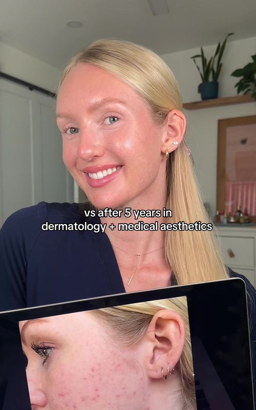 Acne, oily skin, anti aging, glowy skin, hyperpigmentation… it’s all in there!! Free because I love you! ❤️ #aestheticnurse #acnetreatment #acneproneskin #dermatologist #skintransformation 