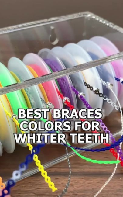 Best Braces Colors for Whiter Teeth #bracescolors #bracestips #smiletips #dentalcare #orthodontics #beautytips #whiterteeth #smilemakeover #styletips #selfcaretips #confidenceboost #dentalhygiene #teethcare #beautyhacks #smileconfidence