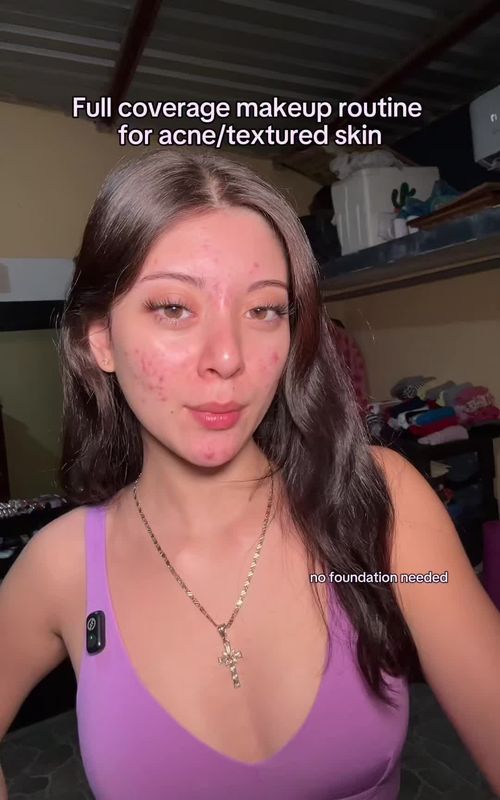For my acne girlies, hope this helps🤍 #acneproneskin #makeuptutorial 