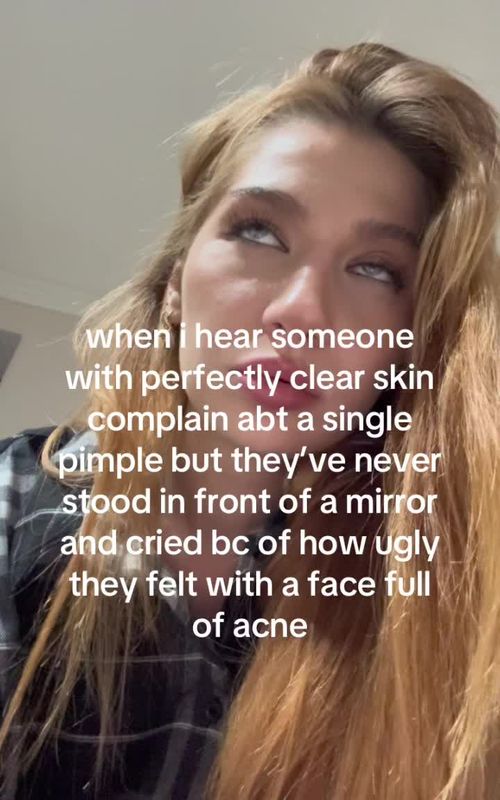 thankfully puffin acne tracker has been helping me clear it recently but this always breaks my heart 💔 #skincare #acneproneskin #skincareroutinetips #acnejourney #acnefighter 