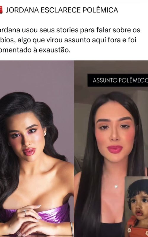 🚨 JORDANA ESCLARECE POLÊMICA 😳 Jordana usou seus stories para falar sobre os lábios, algo que virou assunto aqui fora e foi comentado à exaustão. Ela explicou a situação de forma direta e tentou encerrar o ruído, mas pelo visto vai ter que desenhar, porque tem gente que faz questão de não entender o óbvio. Hater, quando quer implicar, nem explicação resolve. E vocês, gostam quando a Jordis aparece e grava vários vídeos assim? 🤔