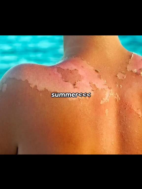 #onthisday !! 1 YEAR AGO #onthisday #cwilien #foryou #viral #Summer 