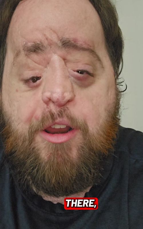 Cash App lets me buy Bitcoin, but their AI facial recognition blocked me from sending it—and support explicitly said "no manual review process. AI bias is actively restricting people with facial differences from using these online financial services.@Cash App , do better. @Spencer West  @CrutchesAndSpice.com|CRIPPLED  @Washington Post Live  @The Daily Show @Drew Barrymore @HuffPost  #CashApp #TechDiscrimination #AIBias #FacialRecognition #Accessibility 
