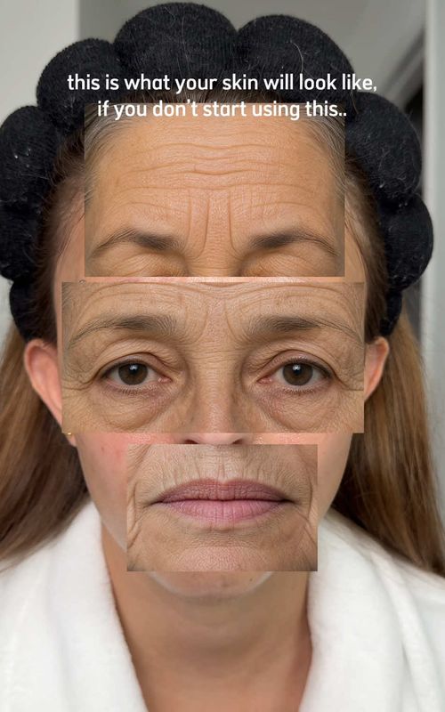 this is your sign before your skin starts looking like this… 😭 everyone calls it “botox in a bottle” and now i get it… #skincare #glassskin #koreanskincare #antiaging #hydration @anua_global 