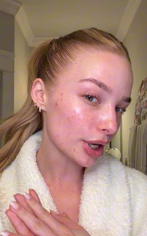 My realistic nighttime skincare routine as a girl struggling with acne 🫧🧴my acne journey has never been linear so I wanted to keep it real with yall 🫶🏻 #acneproneskin #acneskincare #skincareroutine #acnescars #realskin 