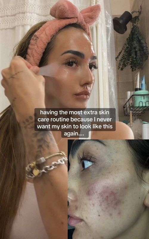 #CapCut #skincareroutine #skincare I would gladly spend 30 mins on my skin care routine than have bad skin ever again 🧖🏻‍♀️🧖‍♀️✨🩷 